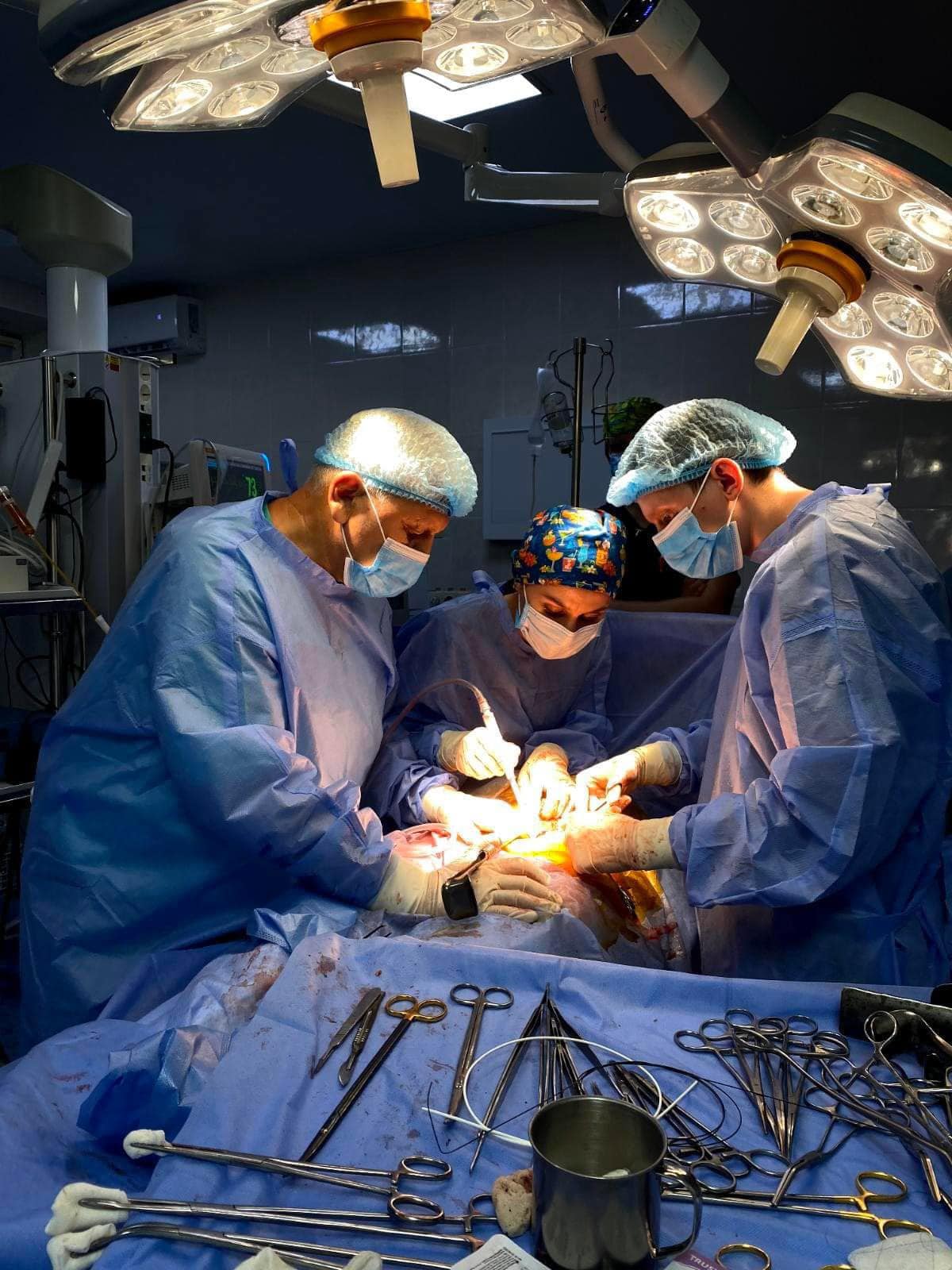 фото операції з трансплантації нирок від посмертного донора