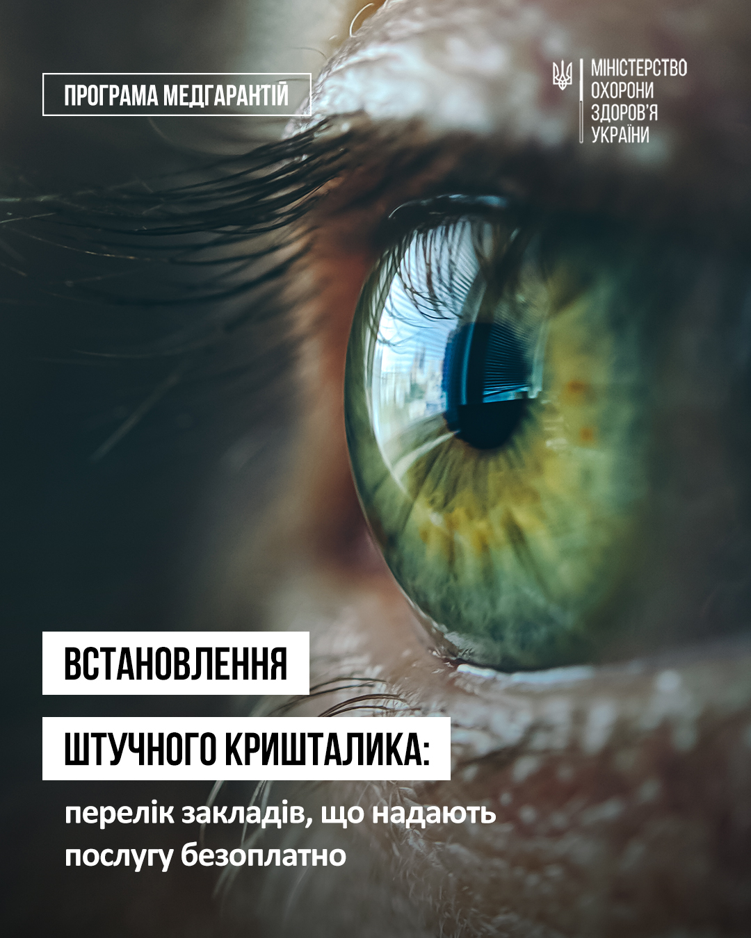  Пацієнти з катарактою можуть безоплатно отримати послуги зі встановлення штучного кришталика